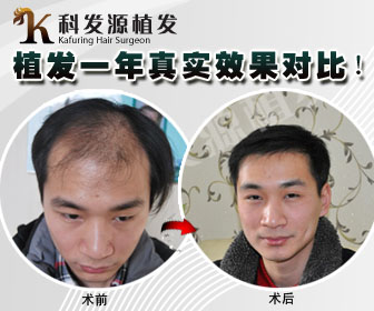 科發(fā)源植發(fā)長沙分院即將盛大開業(yè)